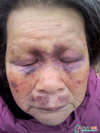 村支书妻子毒打8旬老人 支书被停职