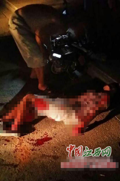 大二女生夜间回家途中遭遇抢劫被刺6刀