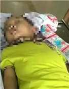 林宇