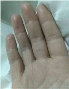 瑞婷