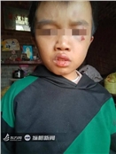 张康康
