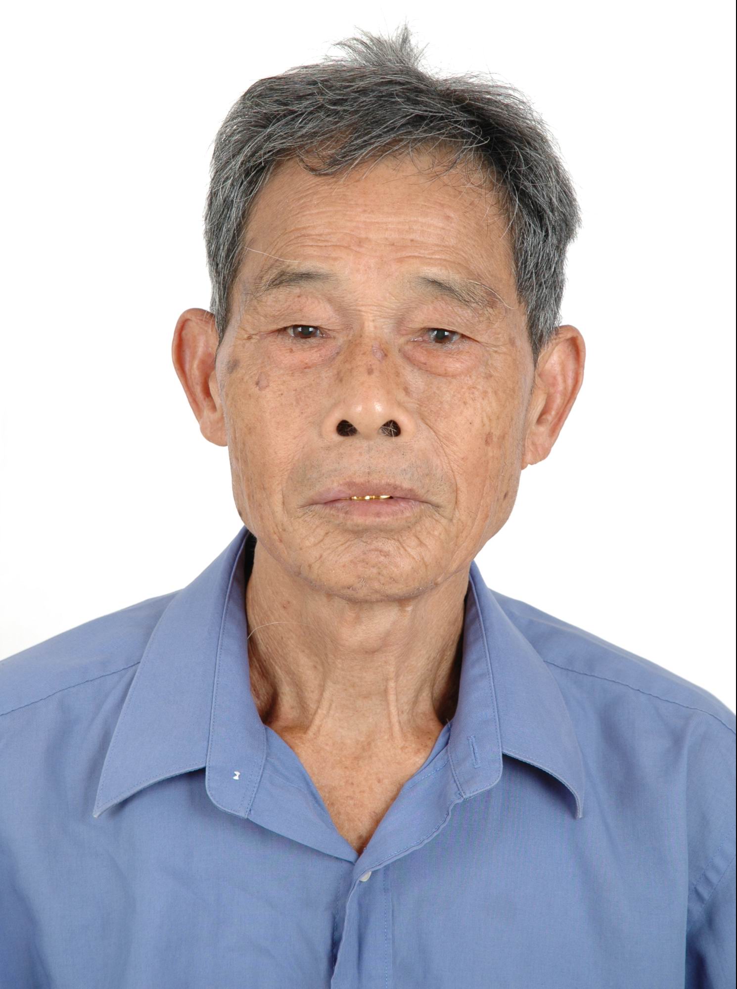 张揖