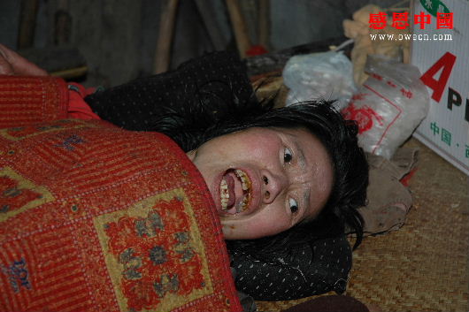李秀琼